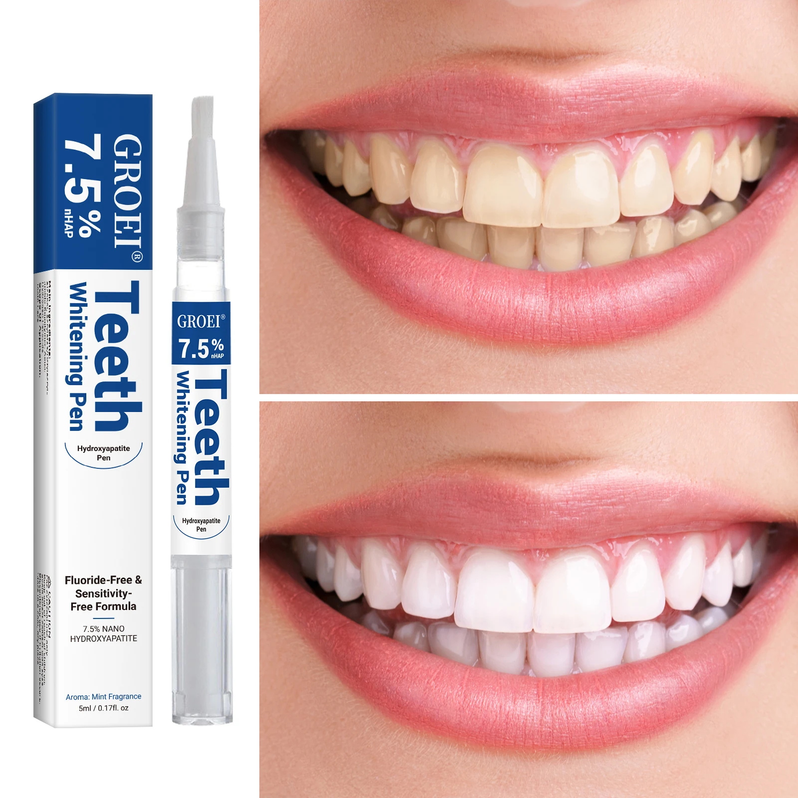 Stylo de blanchiment des dents - Teeth Whitening Essence avis et prix