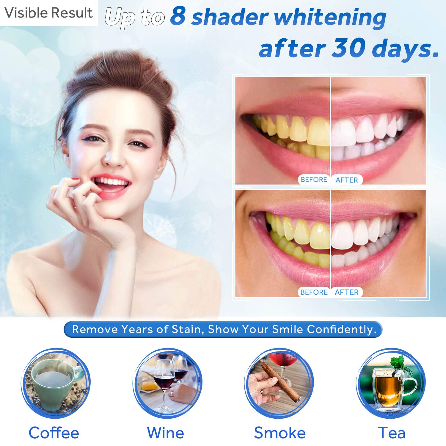 Gel de blanchiment des dents r - Teeth Whitening Essence avis et prix