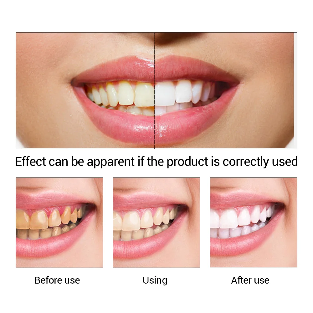 FTEENPLY poudre d'essence de b - Teeth Whitening Essence avis et prix